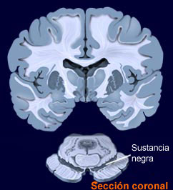 substantia_nigra.jpg