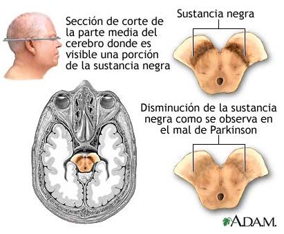 sustancia-negra-y-mal-de-parkinson.jpg