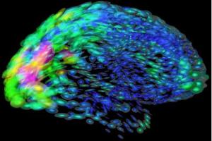 diferencias-neurológicas-en-el-cerebro-prof-toga